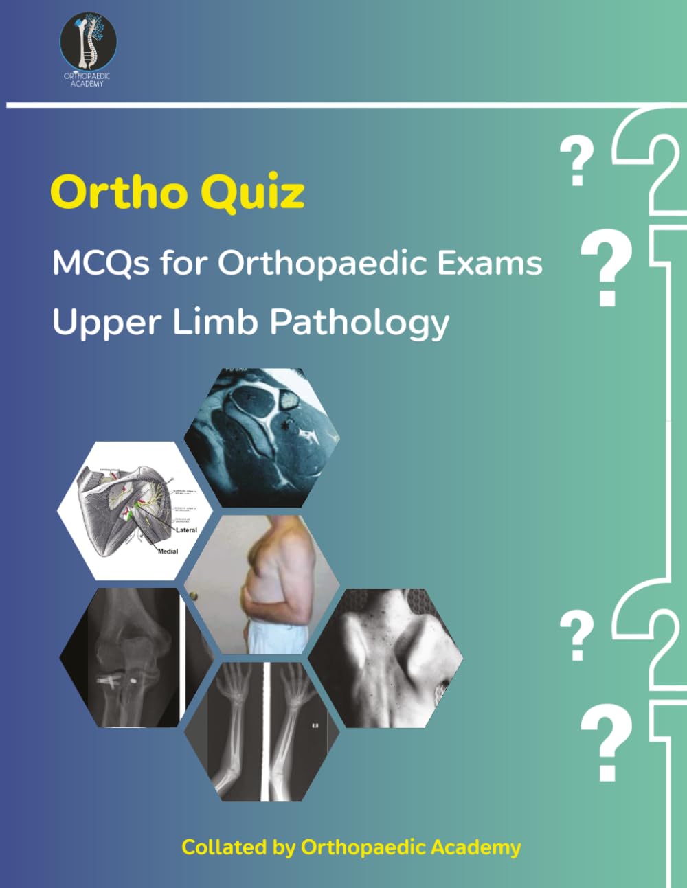 Ortho Quiz: Upper Limb Pathology (Concise Orthopaedics)