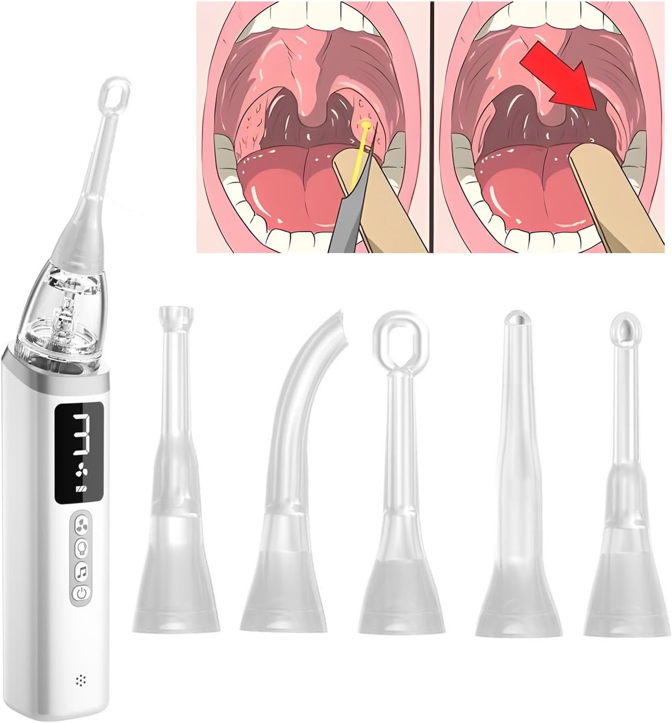 Rechargeable Tonsil Stone Suction Device with Led Light and 3-Speed Suction Electric Tonsil Stone Removal Kit, Eliminates Bad Breath(008)