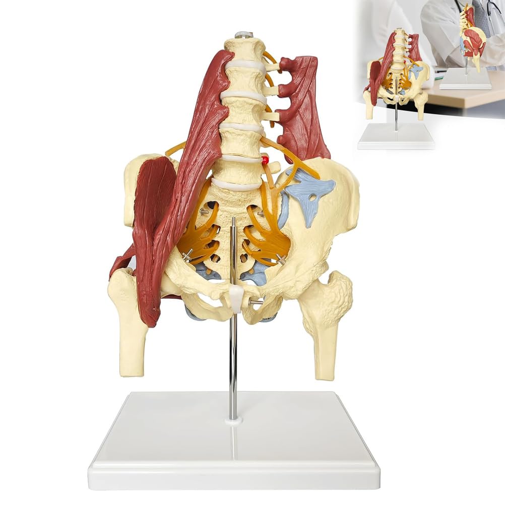 Modello della colonna vertebrale lombare con bacino femminile, modello anatomico umano a grandezza naturale per l'educazione medica, testa del femore, nervi e supporto per lo studio dell'articolazione