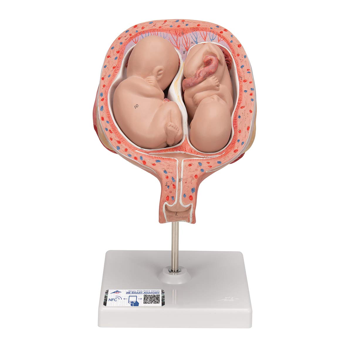 3B Scientific L10/7 5th Month Twin Fetus normal position - 3B Smart Anatomy
