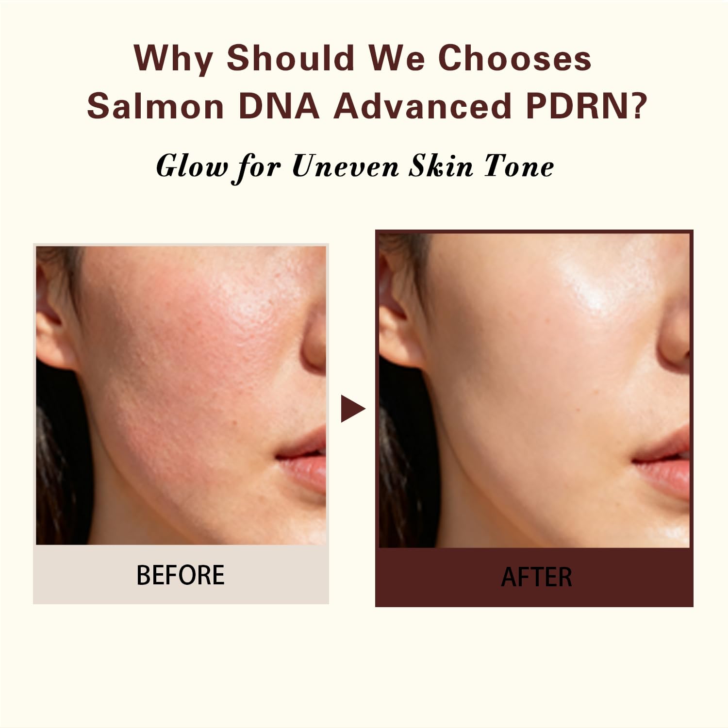 Advanced PDRN Rejuvenating Cream, 99% Pure Salmon DNA Collagen Gel Repair Cream, 0.7 oz, with Hyaluronic Acid and Niacinamide, Nighttime Skin Repair,Inspired Skincare - Image 3