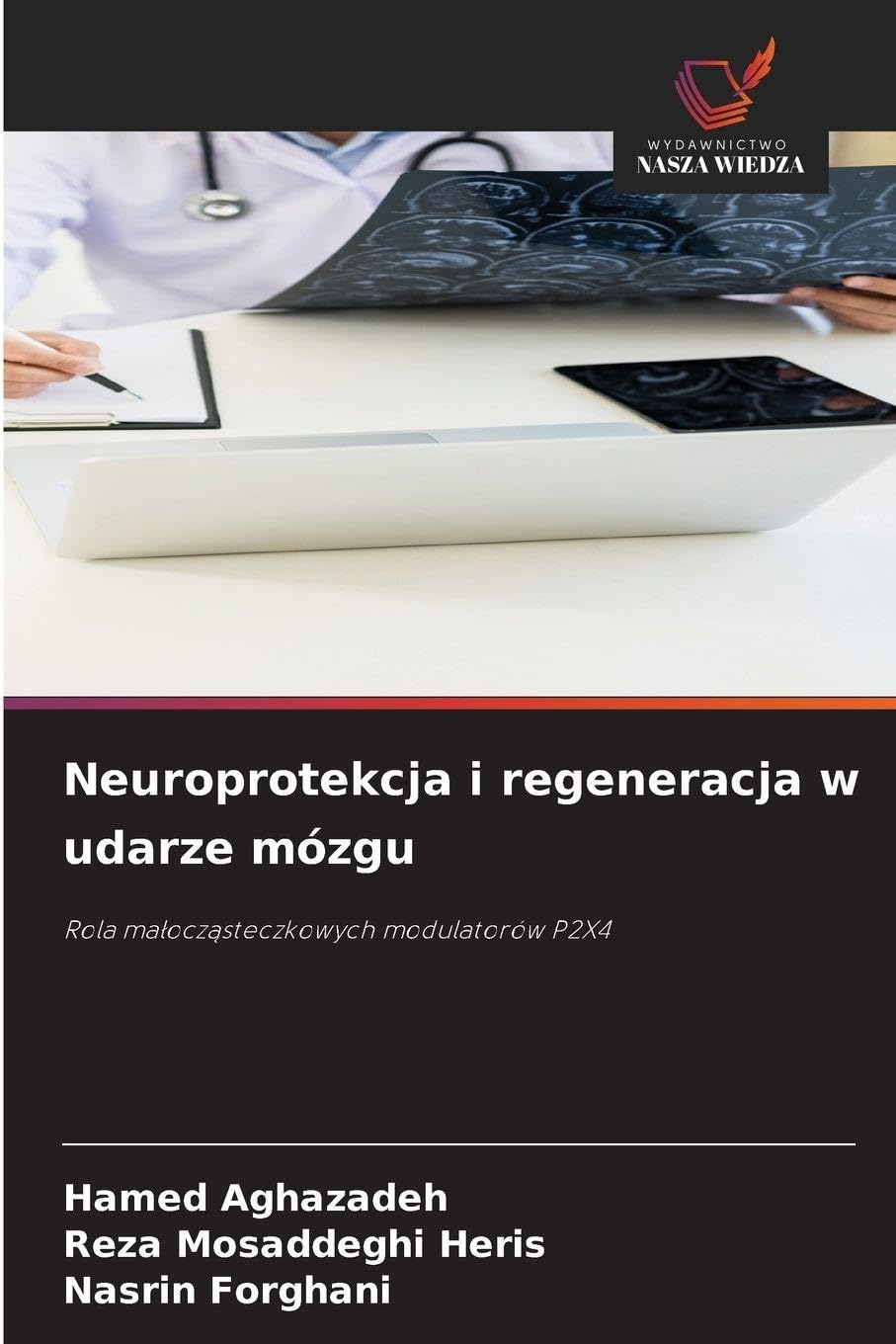 Neuroprotekcja i regeneracja w udarze mózgu: Rola ma¿ocz¿steczkowych modulatorów P2X4