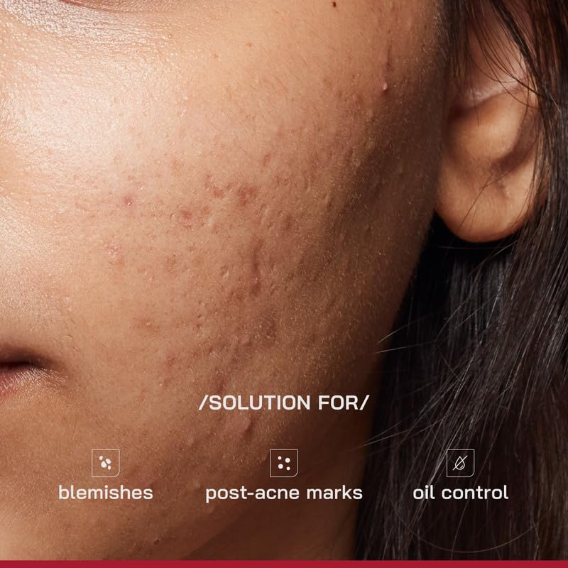 Image of /PHD / 10% Niacinamide Spot Correcting Serum | Niacinamide for Oily Skin, Acne Scars & Enlarged Pores | Face Serum for Acne-Prone Skin with 2% NAG | Fades Marks, Controls Oil I 90ml
