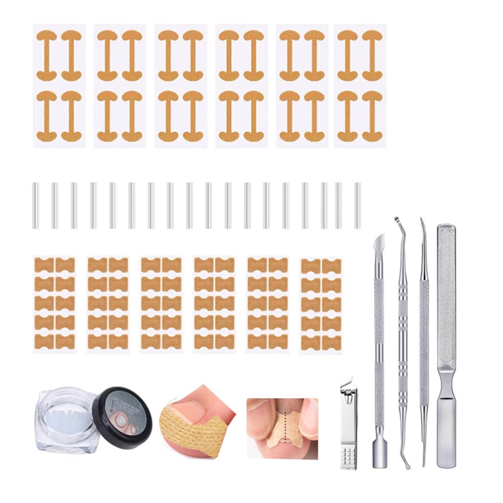 Ingrown toenail treatment, Professional ingrown toenails pedicure tool set, 60Pcs Breathable Toenail Corrector Patch with File and Lifter for Home Pedicure Care