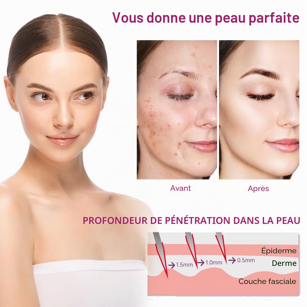 Derma Roller, 6 En 1 Derma Roller 0.5/1/1.5/2mm, Micro Aiguilles Rouleau, Dermaroller Appareil Anti-rides Anti-âge, Retrait de Cicatrice Acne Vergetures, pour Visage Corps Yeux
