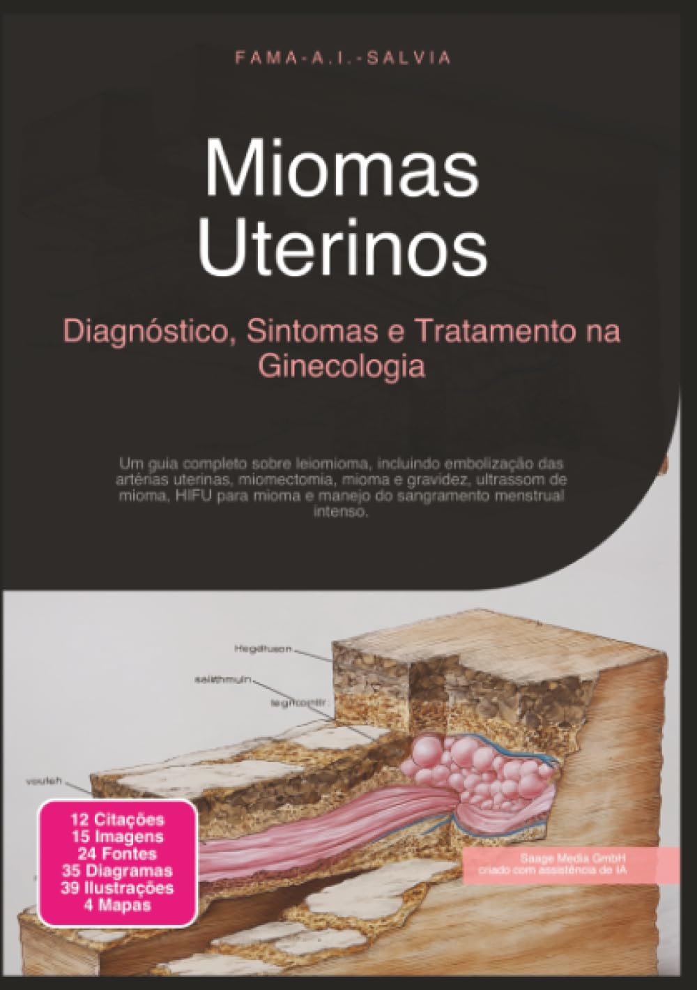 Miomas Uterinos: Diagnóstico, Sintomas e Tratamento na Ginecologia