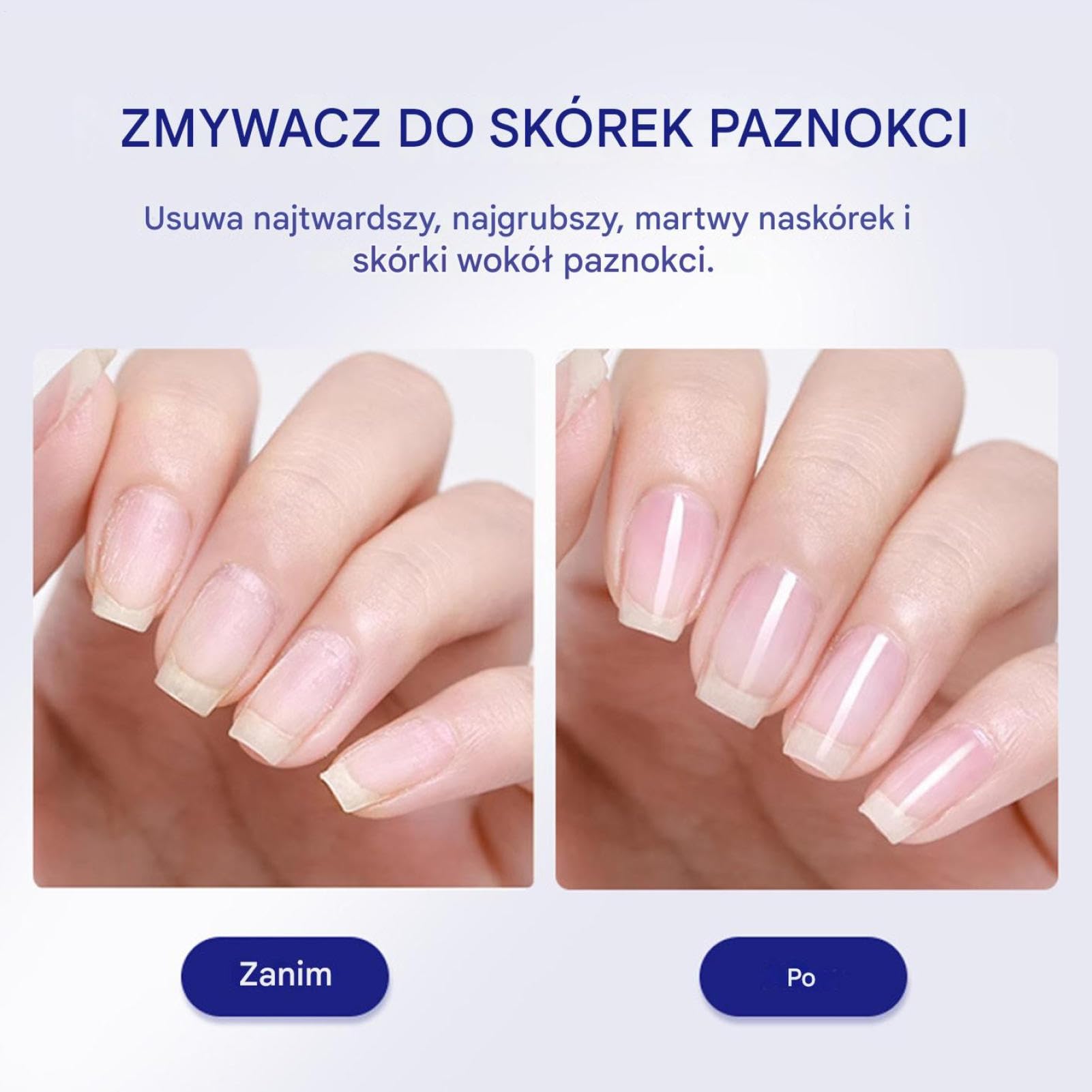 30ml Cuticle Remover Liquid, Hydrating Manicure Tool for Dry, Damaged, or Brittle Nails, Hangnails, Dead Skin, Hands and Feet, Routine, Home or Salon Use, Soft, Smooth, Easy Cuticle Care
