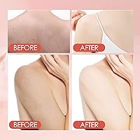 Vista 6 de Exfoliante exfoliante de lodo de melocotón - Exfoliante corporal (11.8 fl oz)