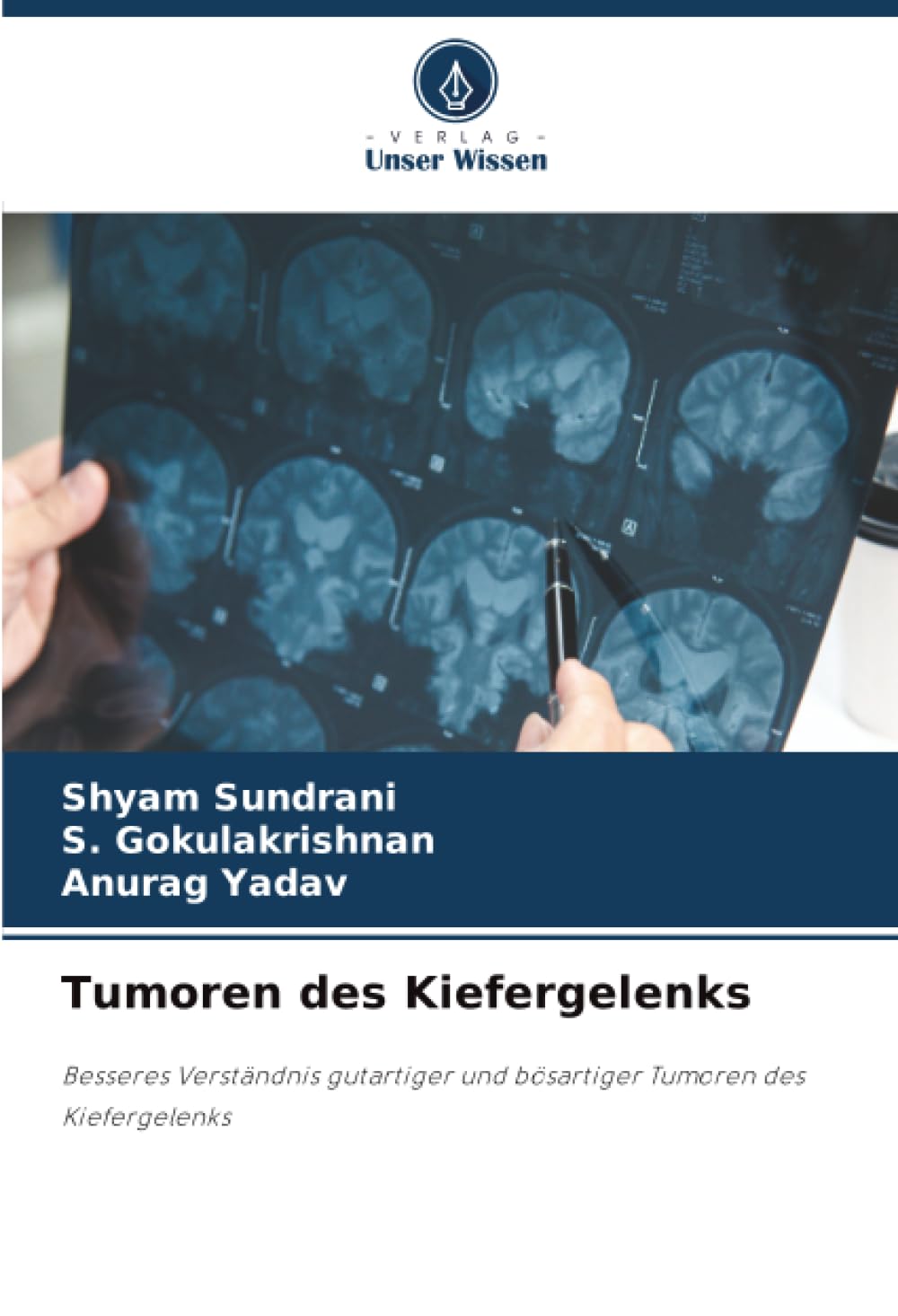 Tumoren des Kiefergelenks: Besseres Verständnis gutartiger und bösartiger Tumoren des Kiefergelenks