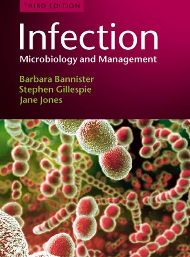 Infection: Microbiology And Management