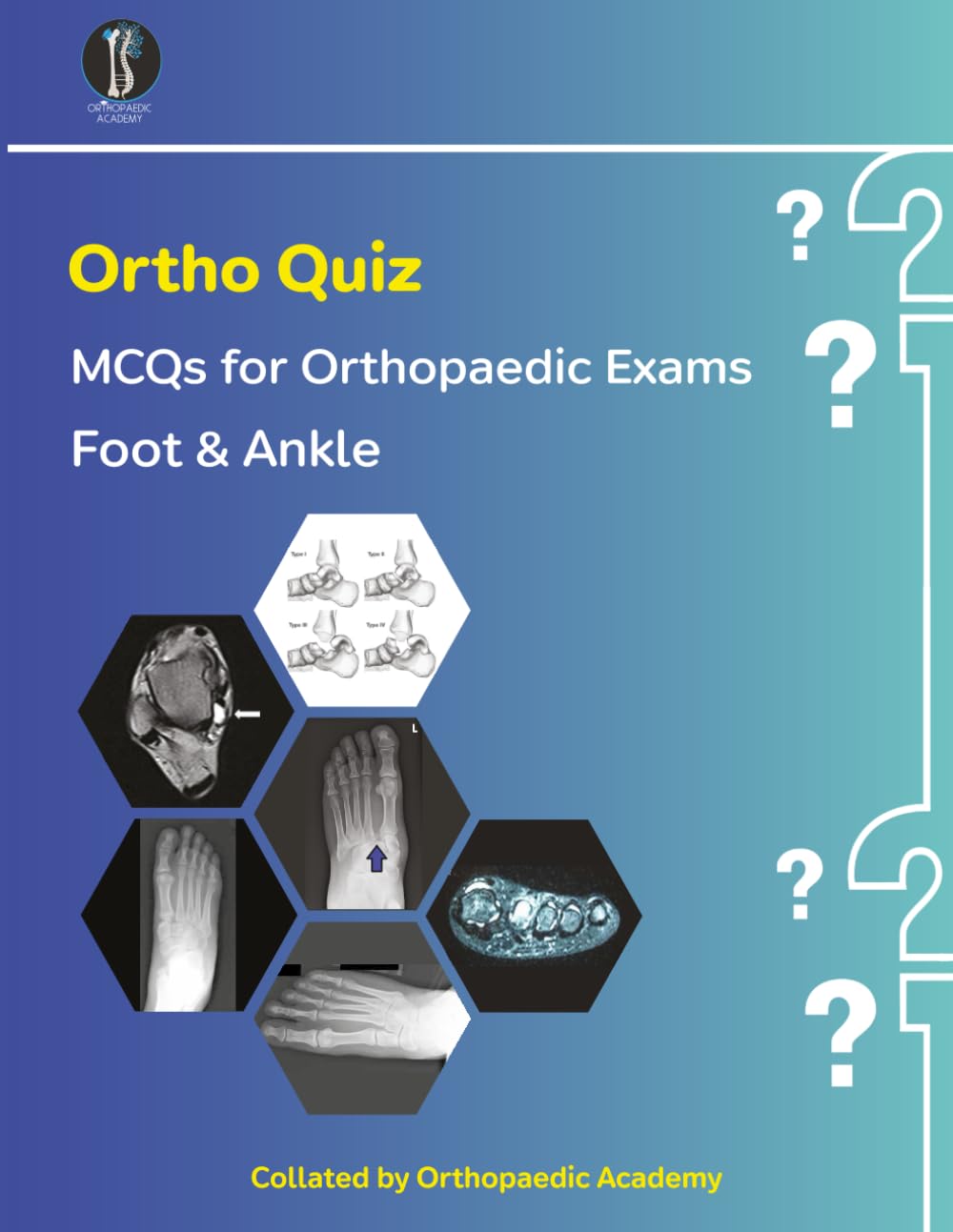 Ortho Quiz: Foot & Ankle (Concise Orthopaedics)