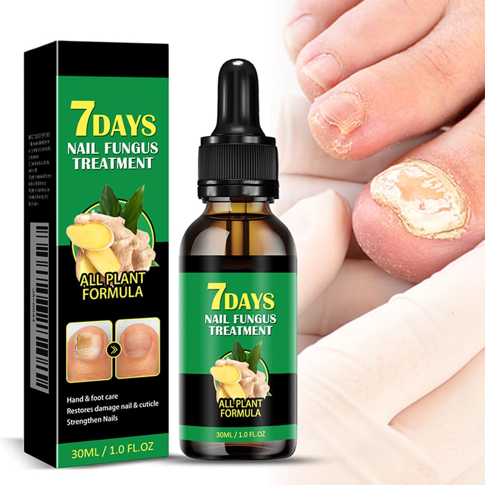 CRGANGZY Ginger Nail Treatment 7 Days Nail Fungus Treatment Ginger Nails Growth Serum,Gingers Cuticle Care Oil for Nails