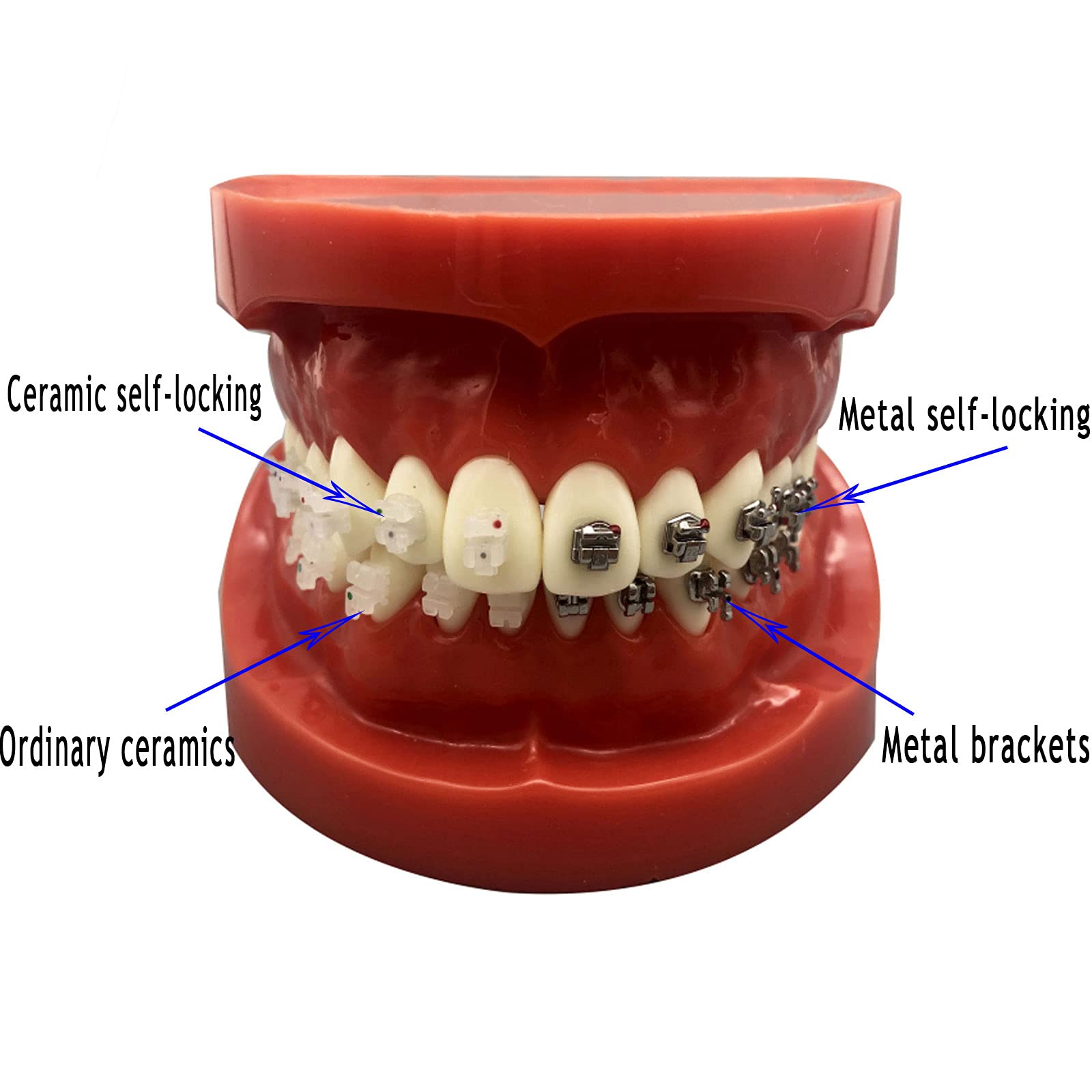 Modelo de Dientes de Implantes Dentales, Modelo de Dientes Dentales, Cuatro Modelos de Comparación de Soportes, Duraderos Adecuado para Intercambios de Demostración Entre Médicos y Pacientes.