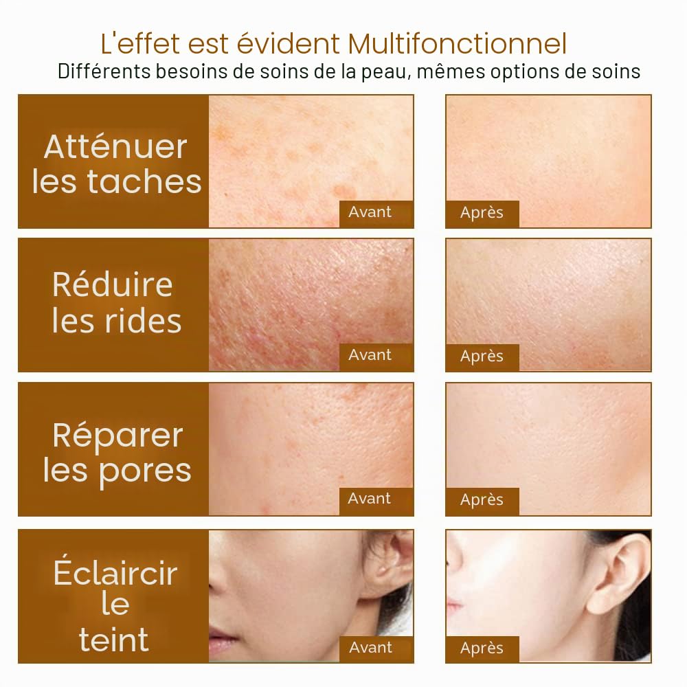192 Dermaroller Système de Micro-aiguilles en Titane Outils de Soins de la Peau du Visage pour le Traitement du Visage, la Repousse des Cheveux, la Croissance de la Barbe,1.5mm