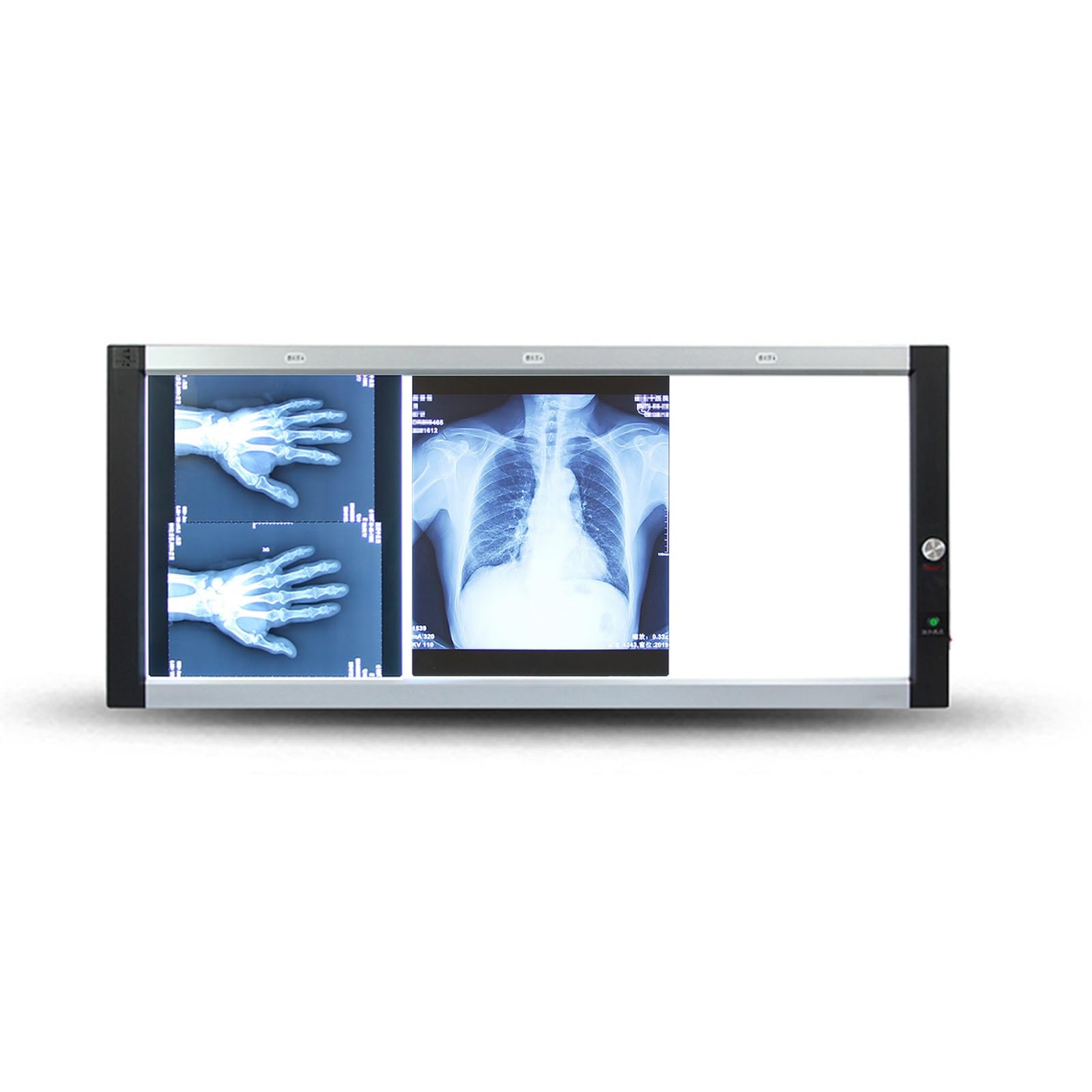 Röntgen-Betrachtungslampe for Krankenhäuser, Professionelle Röntgenfilm-Leuchtbox, Laborausrüstung, 10–100 % Einstellbare Helligkeit, for Medizinische und Zahnmedizinische Zwecke(47x20x1in/119x51x2.5c