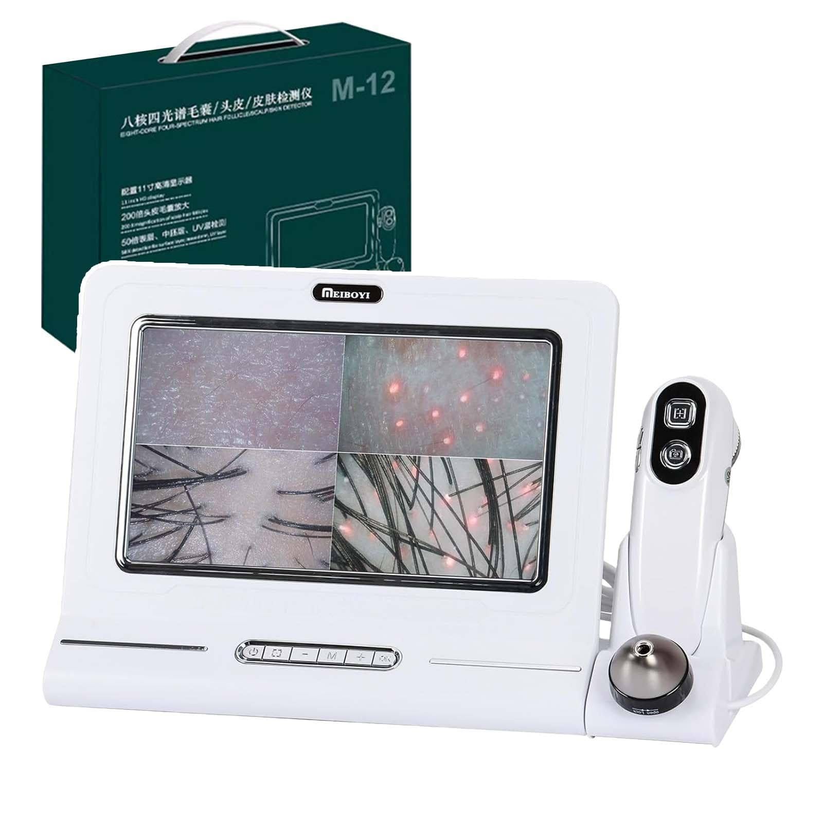 Microscope analyseur de peau et cuir chevelu HD 11" double sonde 50X 200X