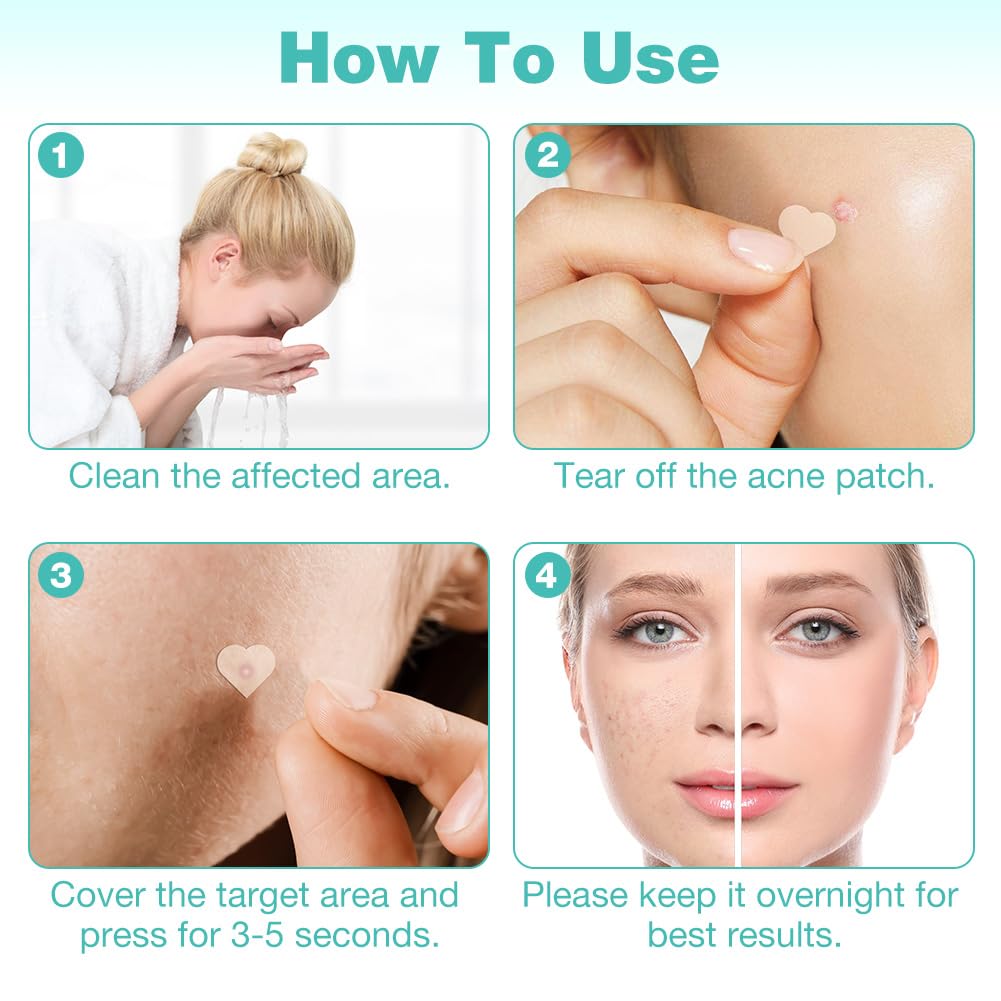 BUTBU Pimple Patches, 400 Pieces Heart Hydrocolloid Spot Patches, Mighty Blemish Patches - Image 4
