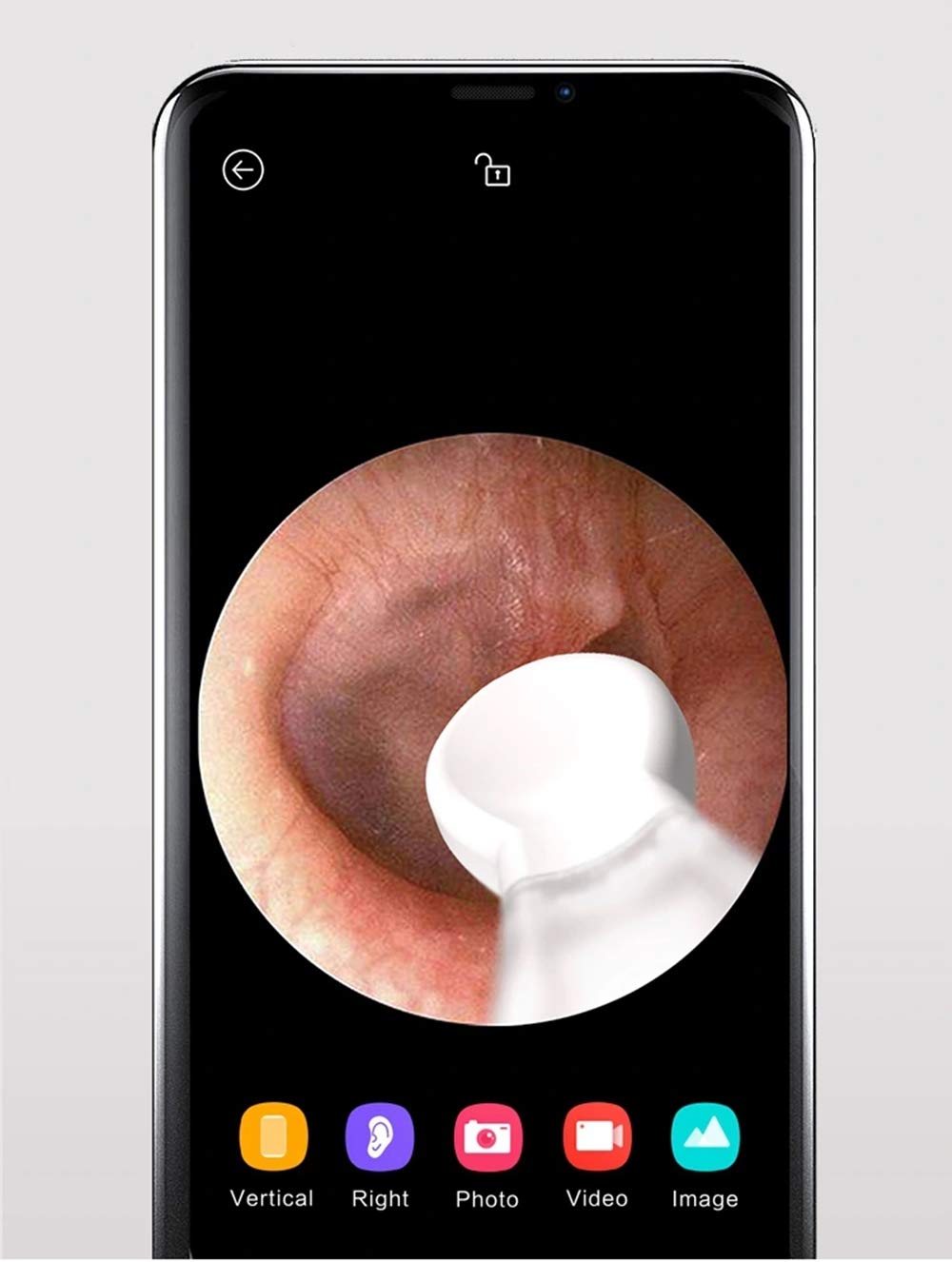 Otoscopio BEBIRD X17 Pro Endoscopio Fotocamera 3MP 3.5mm WIFI Otoscopio，Kit Per La Rimozione Del Cerume HD Portatile，con 6 LED Compatibile con iOS e Android, per Bambini, Adulti， Animali-Blu