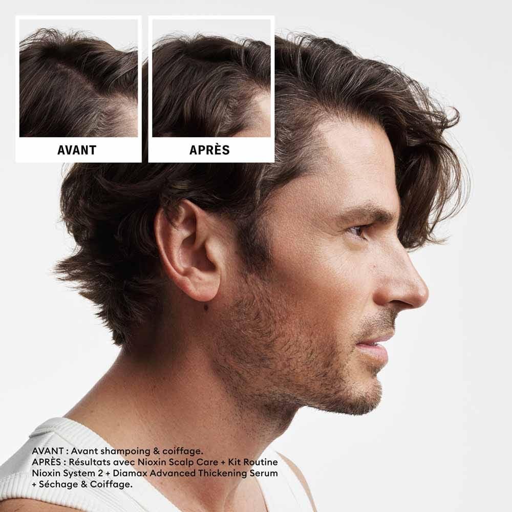 Nioxin prodotto beauty System 2 Loyalty Kit
