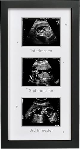 HAMUIERS Marco de fotos de ultrasonido  Marco de triple ecograma para la futura mamá  Decoración de álbum de fotos de embarazo  Artículos esenciales