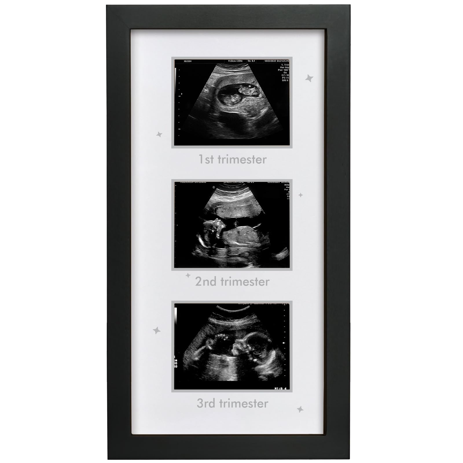 HAMUIERS Ultrasound Picture Frame - Triple Sonogram Frame for Mom to Be | Pregnancy Photo Album Decor | Baby Nursery Essentials & Gender Reveal Gifts | First Trimester Keepsake & Pregnancy Must Haves - Black2