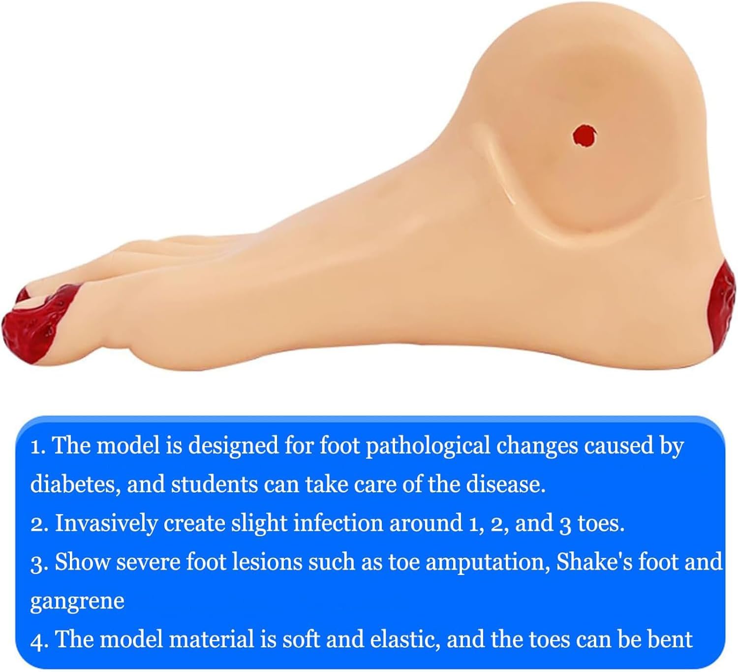 Diabetic Foot Care Teaching Model, Severe Foot Lesion Model, Invasive Lesion Ulcer Model with Toes Infection, Toes Can Be Bent, for Medical Study, Patient Education
