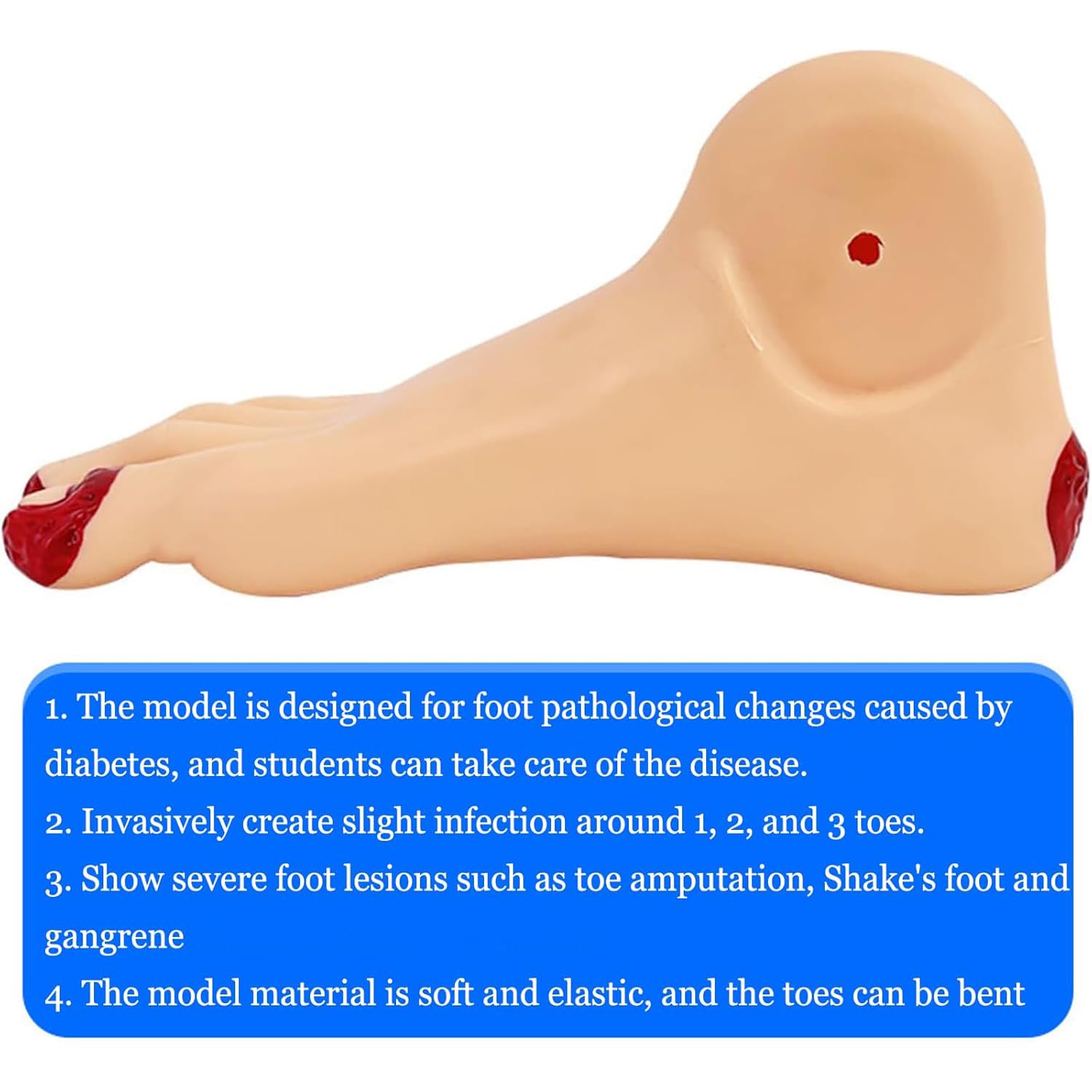 Model nauczania pielęgnacji stóp cukrzycowych, model ciężkiej zmiany stóp z infekcją palców, model inwazyjnego owrzodzenia, palce mogą być wygięte, do edukacji pacjentów i nauk ścisłych