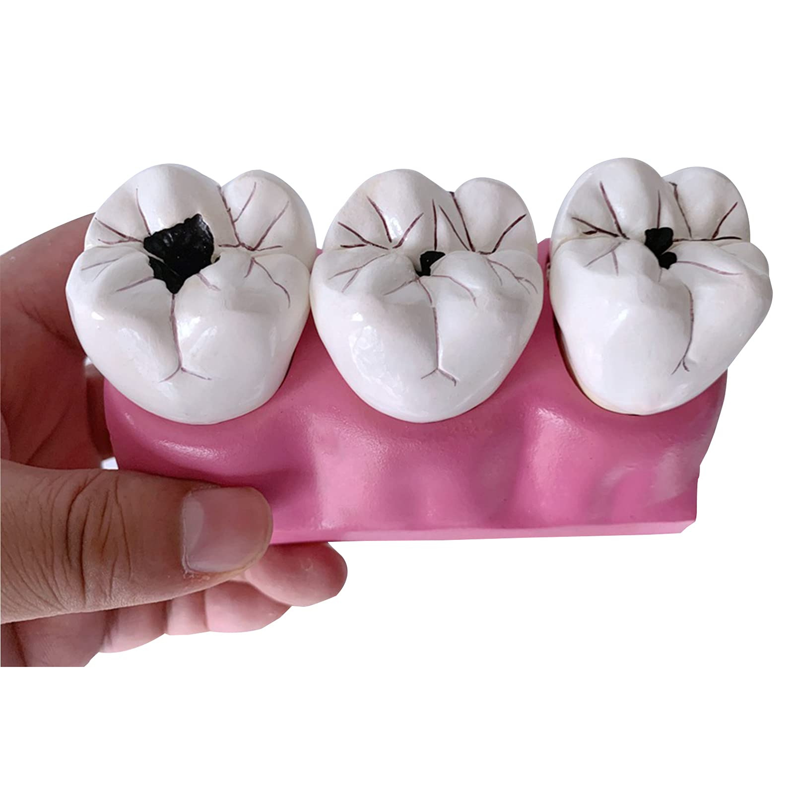 Buy Dental Teeth Caries Model Removable, Caries Teeth Disassembling
