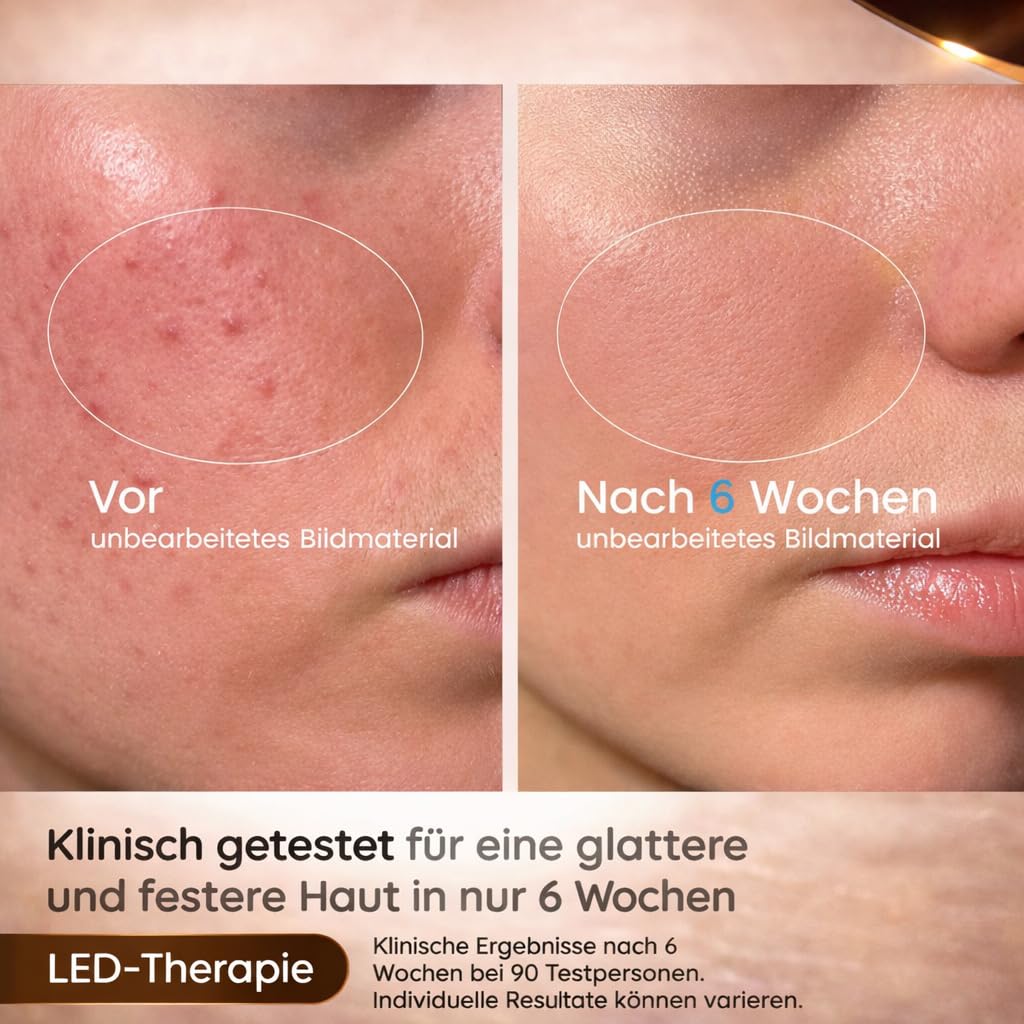LED Lichttherapie Gesichtsmaske mit 7-Farben, Wiederaufladbare Fernbedienung Nahinfrarotlicht Kabellose Falten & Hautverjüngung Hautpflege für zu Hause
