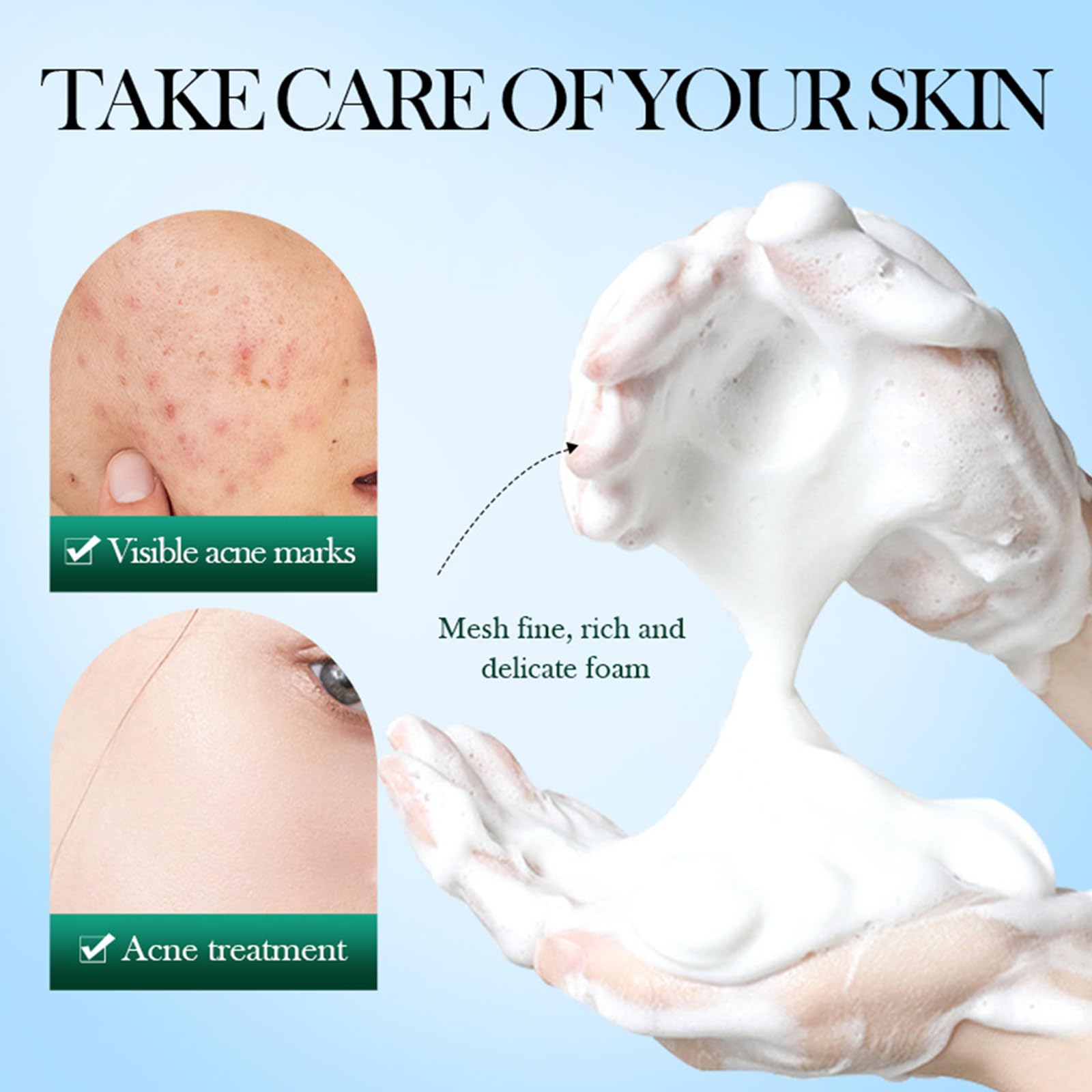 Tea Tree Anti Pimple Face Wash Gel, Cleansing Foam, Anti-Pimple Wash Scrub, Face Cleansing with Tea Tree Oil - Image 3