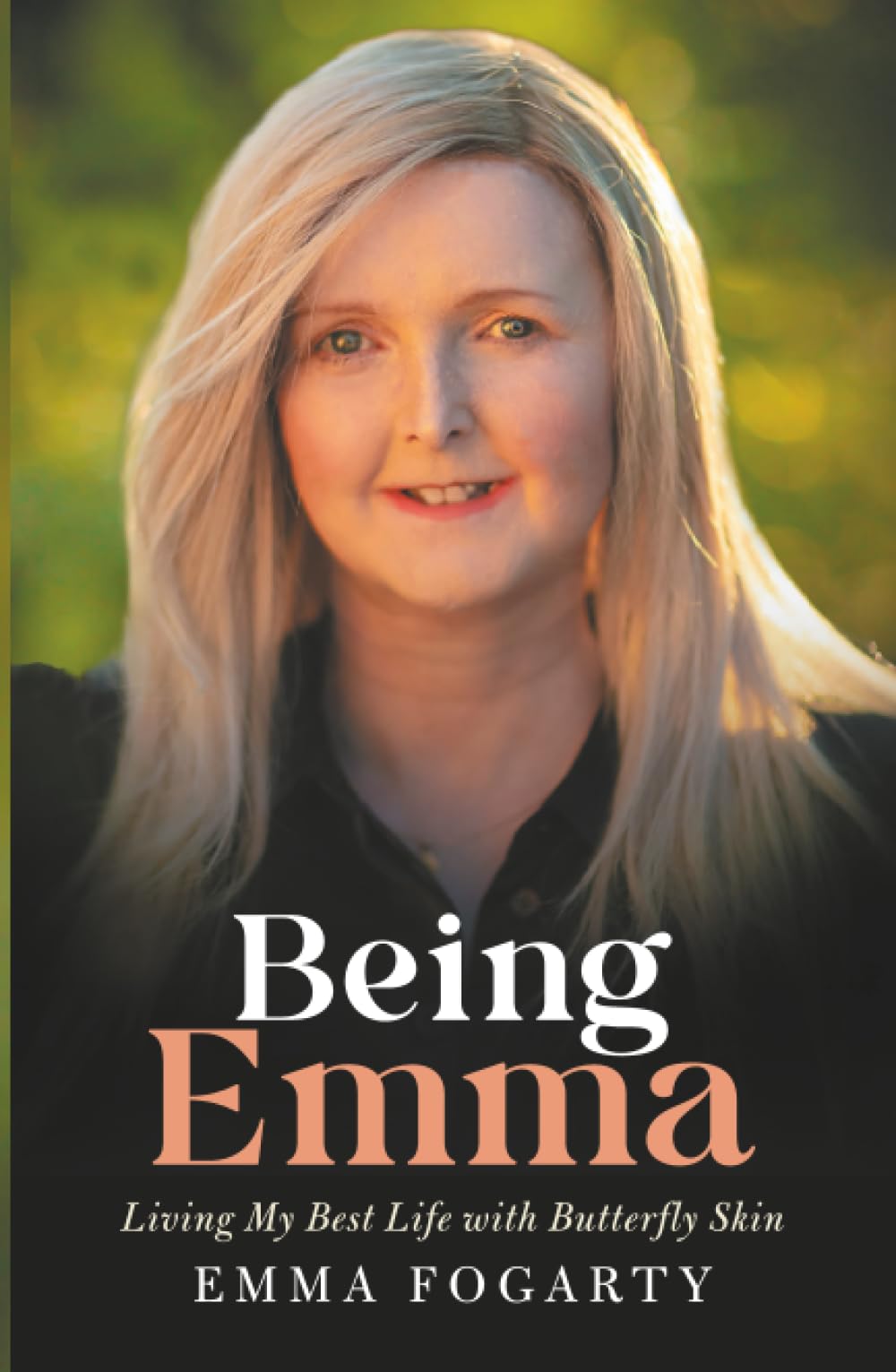 Being Emma: Living My Best Life with Butterfly Skin