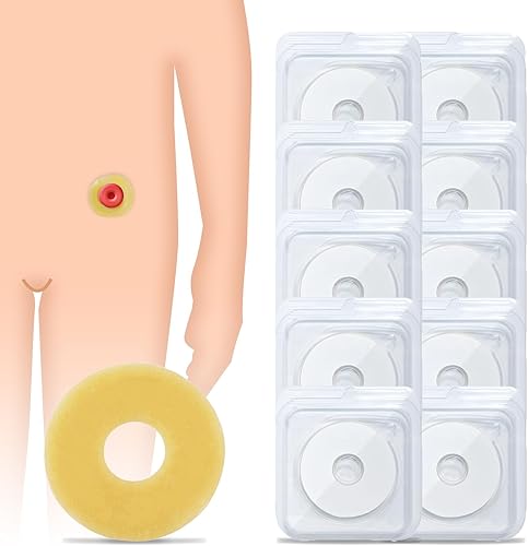 10 anillos de barrera para ostomía, anillos de barrera adaptables moldeables, anillos extensores de piel hidrocoloides, suministros de ostomía
