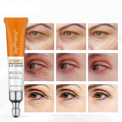 Amazing Eye Cream, 1 Minutes To Remove Bags Under Eyes Wrinkles Dark Circles And Puffiness, Obvious Effect Vitamin C Anti Aging Eye Cream For Women And Men #TOP3