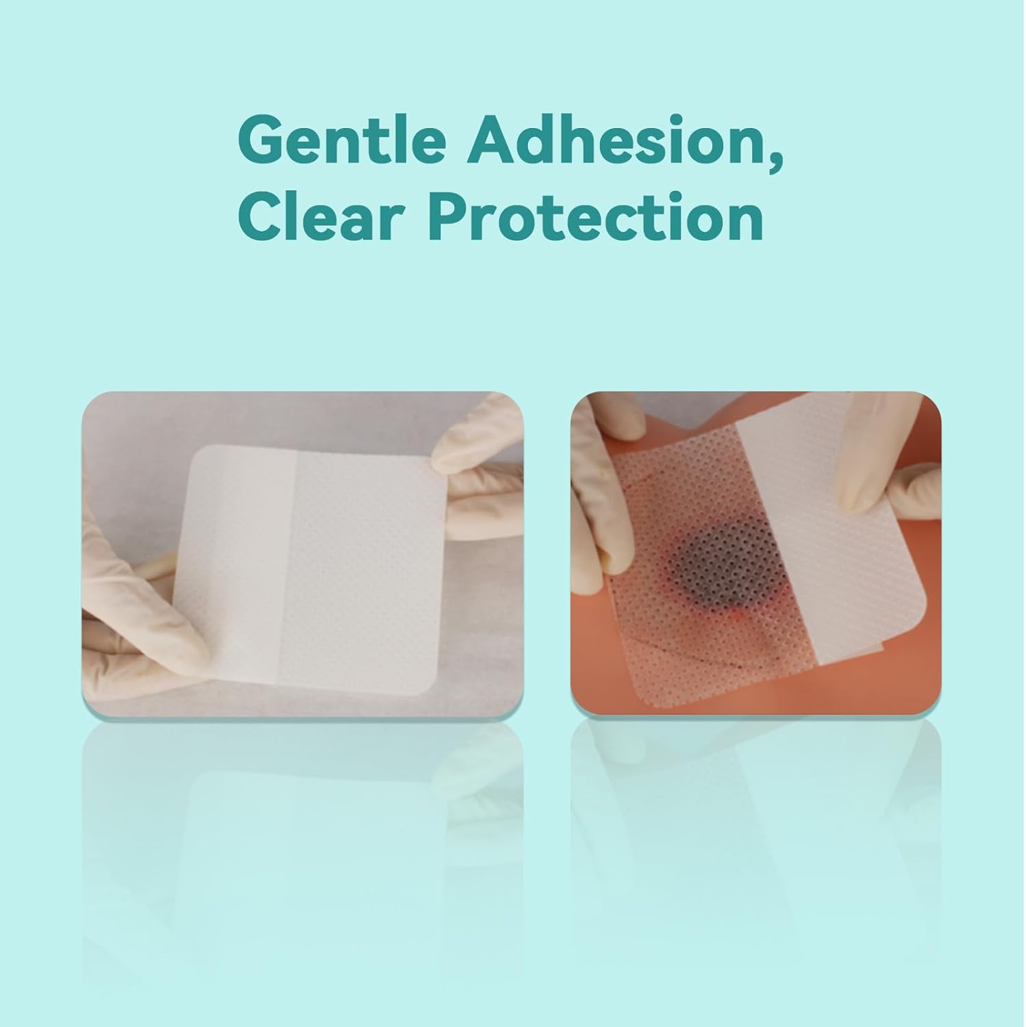 Dimora Silicone Wound Contact Layer, Non-adhering Dressing, Transparent Wound Dressing Pads, 3in x 4in (7.5cm x 10cm), 10 pcs - Image 3