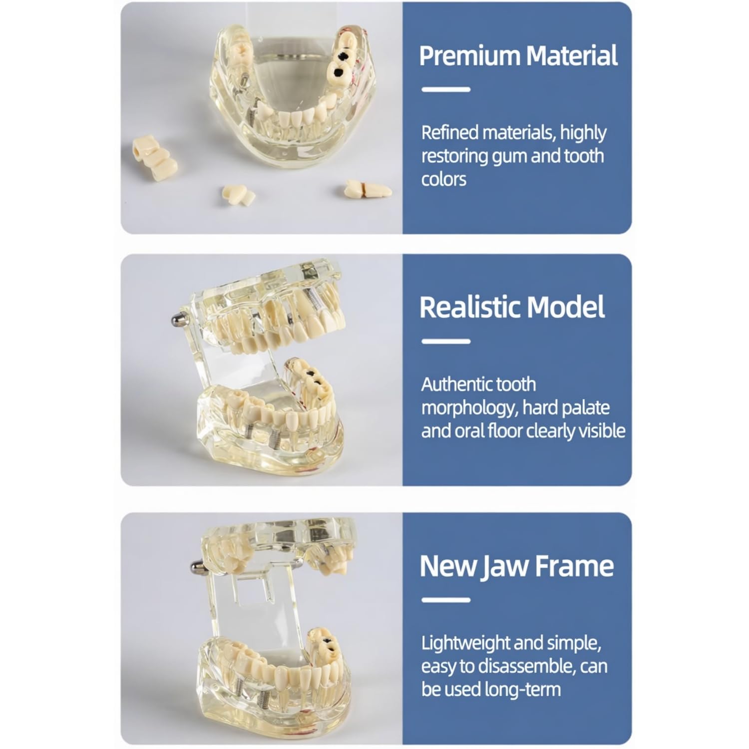 Modèle Dent, Modèle Dentaire Pédagogique Transparent Amovible, Implant Dentaire Modèle, Modèle Médical d'Enseignement, Modèles et Matériel Dentaire Éducatif pour Étude de la Maladie