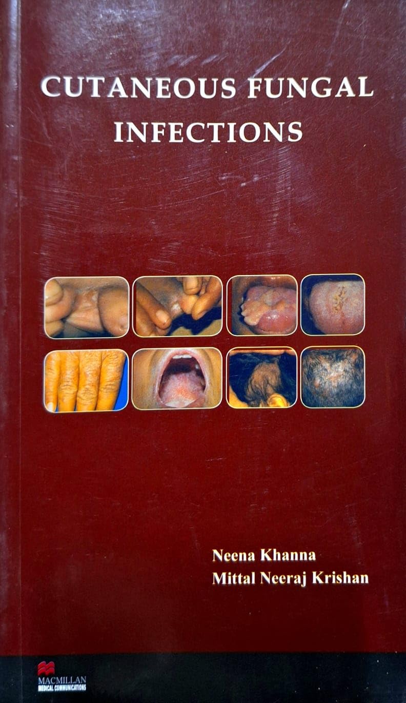 Buy Cutaneous Fungal Infections by Neena Khanna Book Online at Low ...