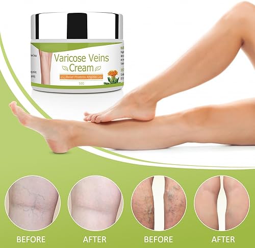 Miniatura 6 de Crema corporal, 100 % natural y pura para venas varicosas, crema para venas varicosas para piernas, elimina las venas varicosas y las arañas