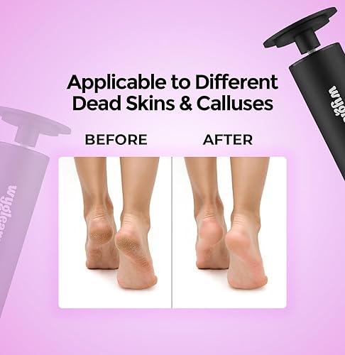 Miniatura 5 de Removedor eléctrico de callos (negro)