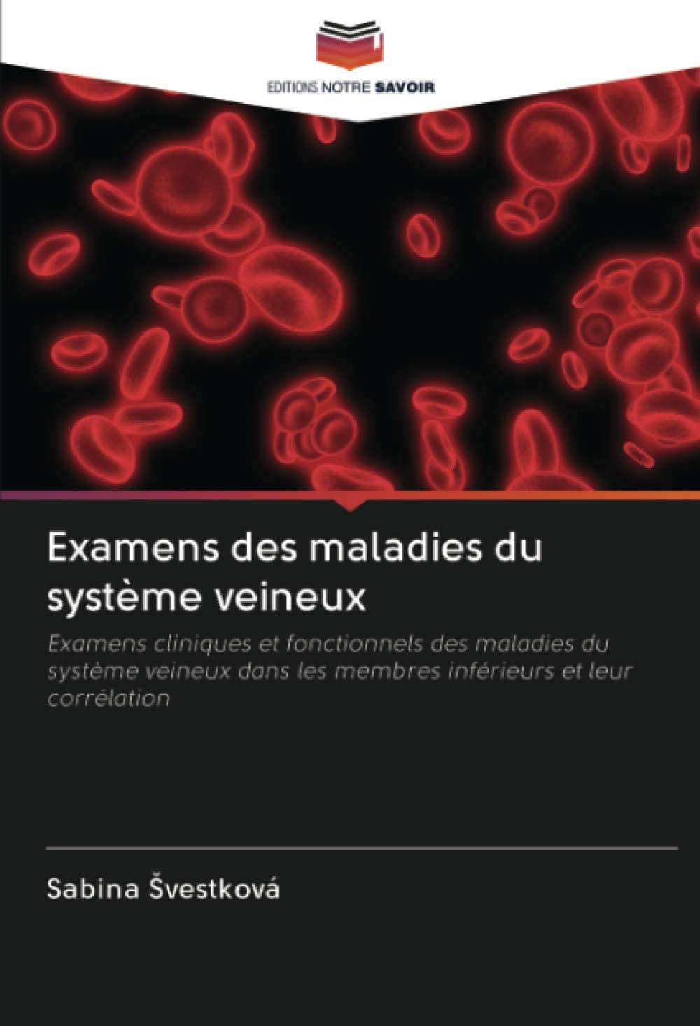 Examens des maladies du système veineux: Examens cliniques et fonctionnels des maladies du système veineux dans les membres inférieurs et leur corrélation (French Edition)