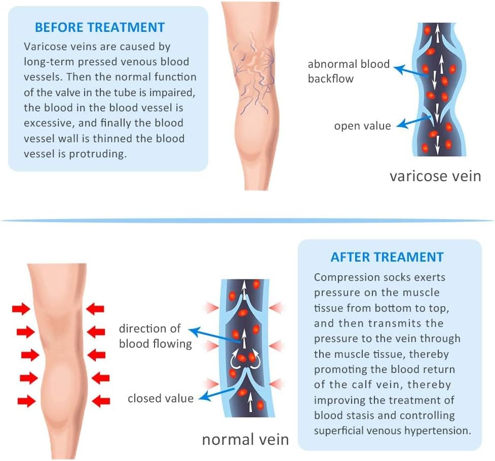 20-30mmHg Compression Pantyhose for Women, Medical Compression Stockings, High Waist Opaque Compression Tights for Lymphadema Edema, Swelling, Varicose Veins, Support Hose for Teacher Doctor - Image 6