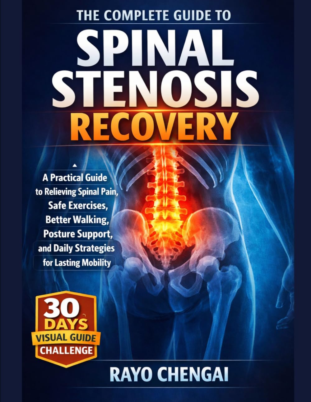 THE COMPLETE GUIDE TO SPINAL STENOSIS RECOVERY: A Practical Guide to Relieving Spinal Pain, Safe Exercises, Better Walking, Posture Support, and Daily Strategies for Lasting Mobility