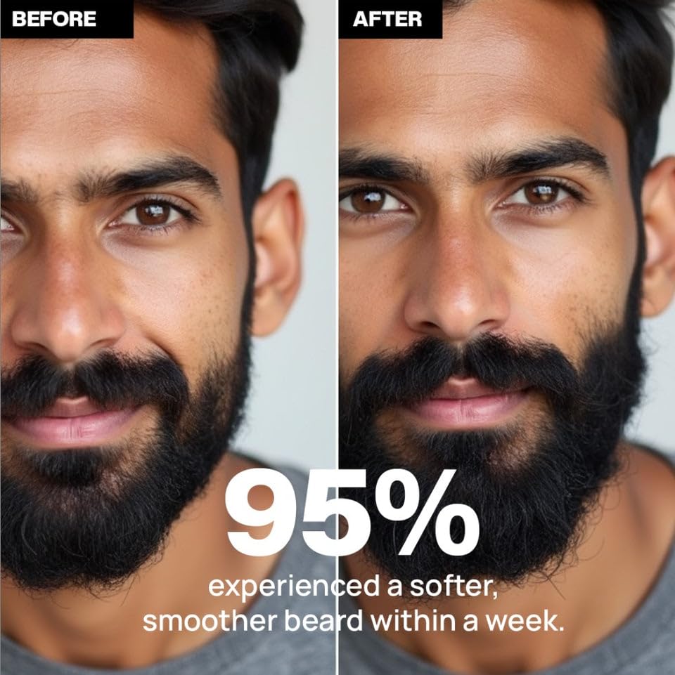 Image of Mufasa Men Beard Growth Serum for Men 30ml - Patchy Beard Solution, Helps Support Thicker Fuller Beard - Lightweight Beard Care & Grooming Serum for Soft Healthy Beard | Beard Serum For mens