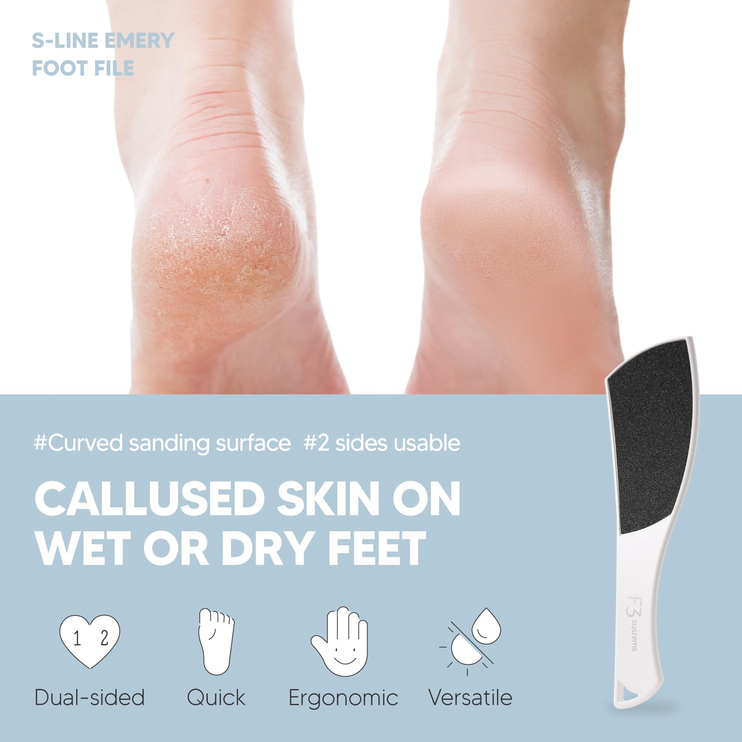 S-Line - Set di lime per piedi (bianco) e spray ammorbidente per piedi, strumento per pedicure, efficace per talloni screpolati, cura dei piedi, strumento colossale per pedicure su entrambi