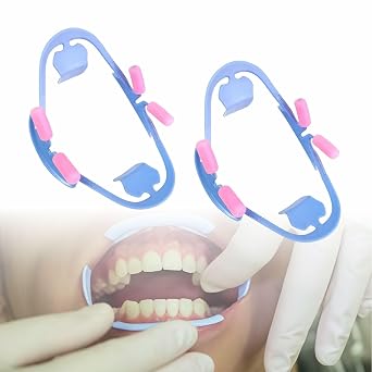Dental 3D Cheek Retractor - Intraoral Tooth Oral Spreader, Mouth Props Opener for Dentist Aid Accessories, 2 Pcs