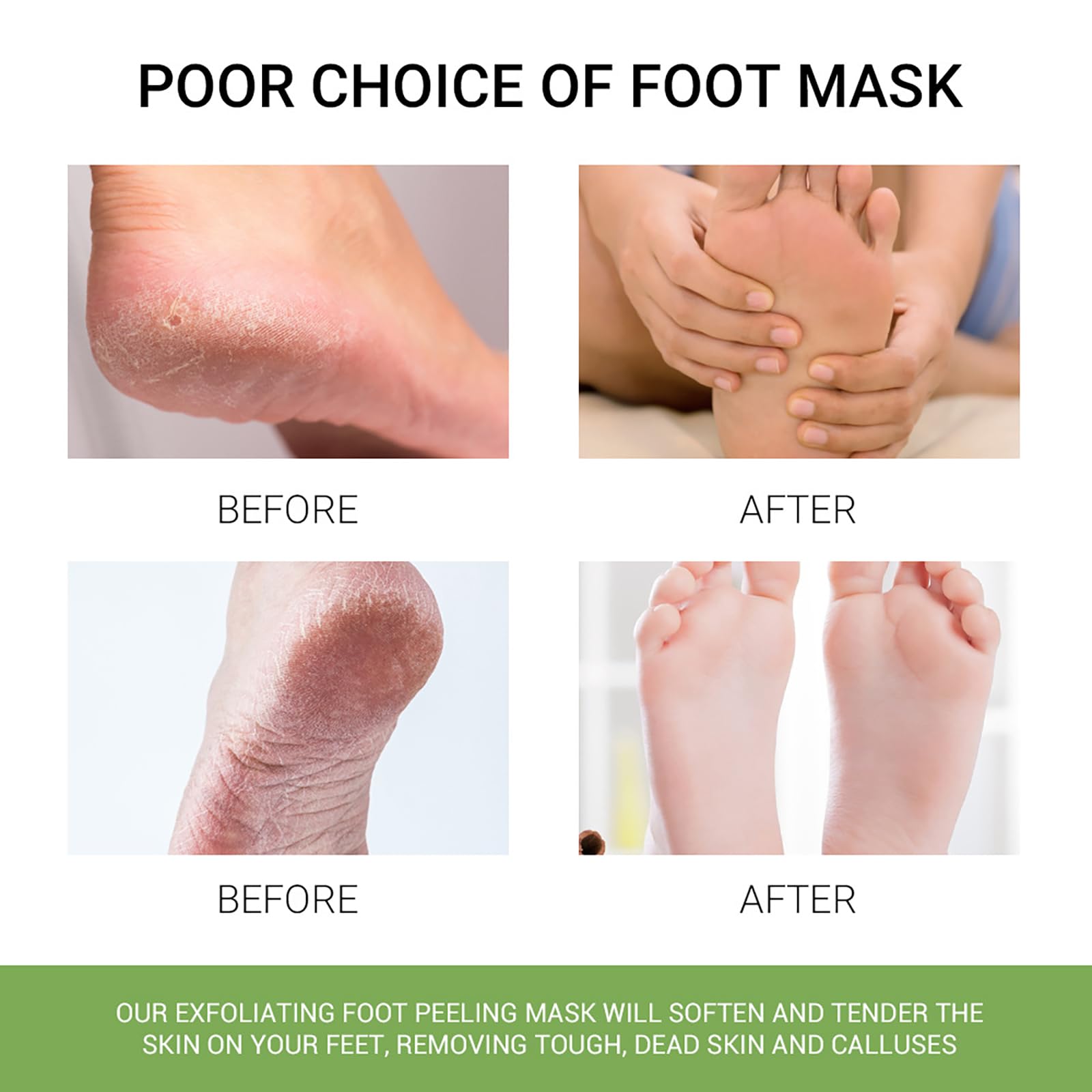 VolksRose Masque Pied à l'Aloe Vera 3 Pièces pour Femmes - Chaussettes Hydratant pour Réparer les Talons - Traitement Hydratant&Nourrissant pour Pieds Secs et Fissurés, Soin Exfoliant et Adoucissant