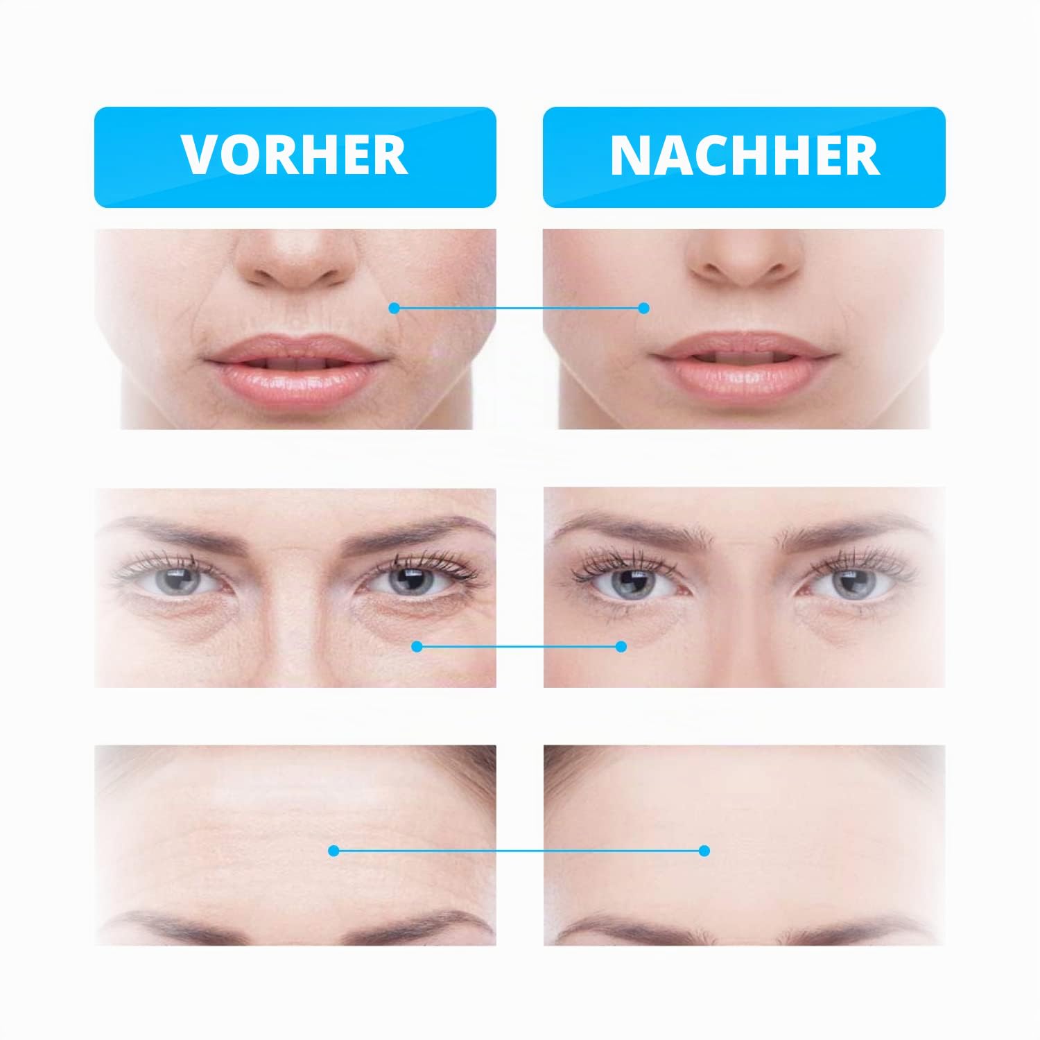 GESS Mikrostrom-Gesichtslifting-Gerät, 4 Intensität Modi, wiederaufladbar, Anti-Aging-Maschine, Konturhautstraffung, Mikrostrom-Gesichtslifter (Schwarz und Blau)