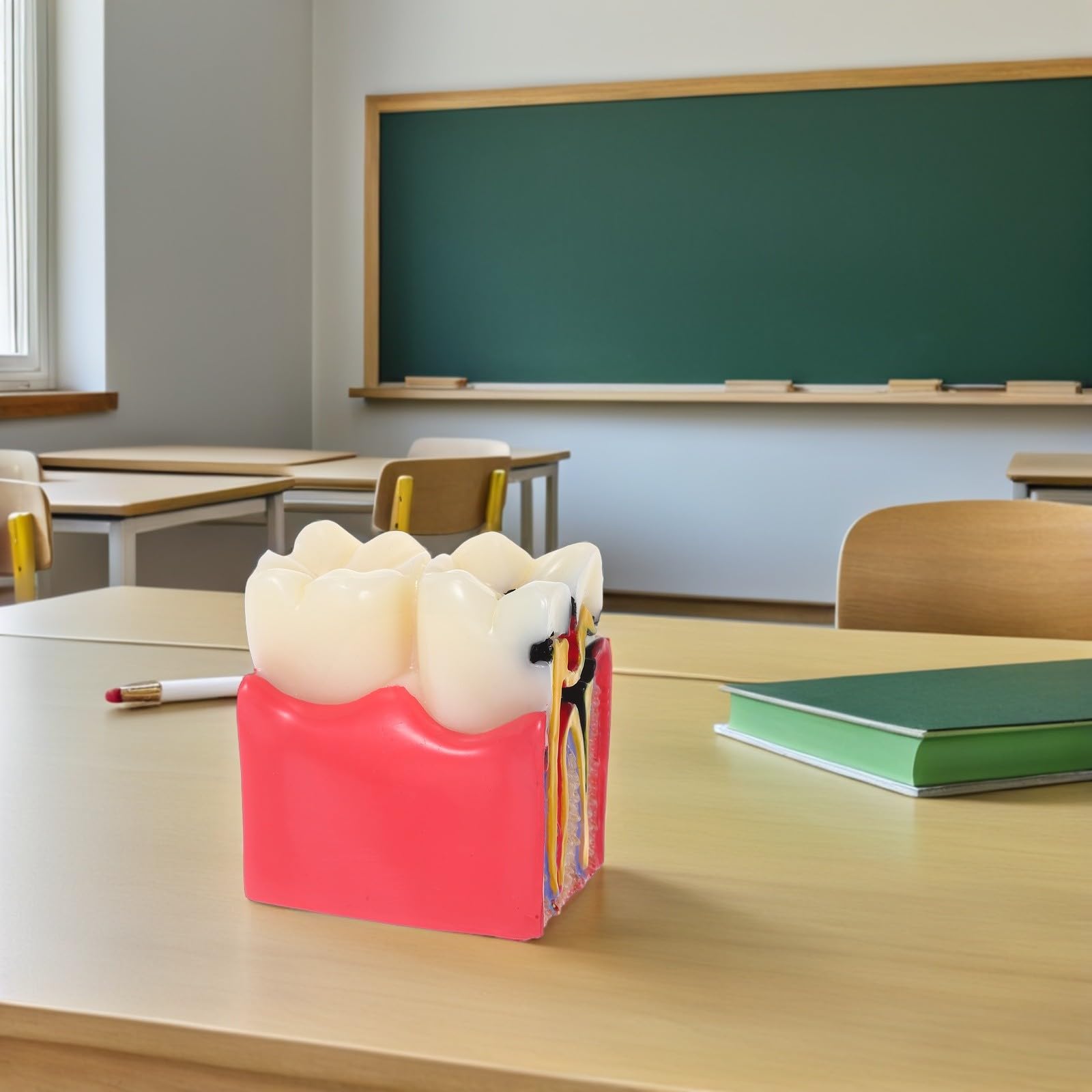 BESTYASH Modèle Pédagogique de Caries Dentaires à 6x Grossissement en Résine, Outil Typodont D'anatomie Comparée Dents Saines Vs Cariées, pour Enseignement en École et Cabinet
