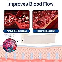 Vista 5 de Vein Target Microdarts Patch, tratamiento profesional de venas varicosas para piernas, parche GFOUK Vein Target, alivia la circulación sanguínea