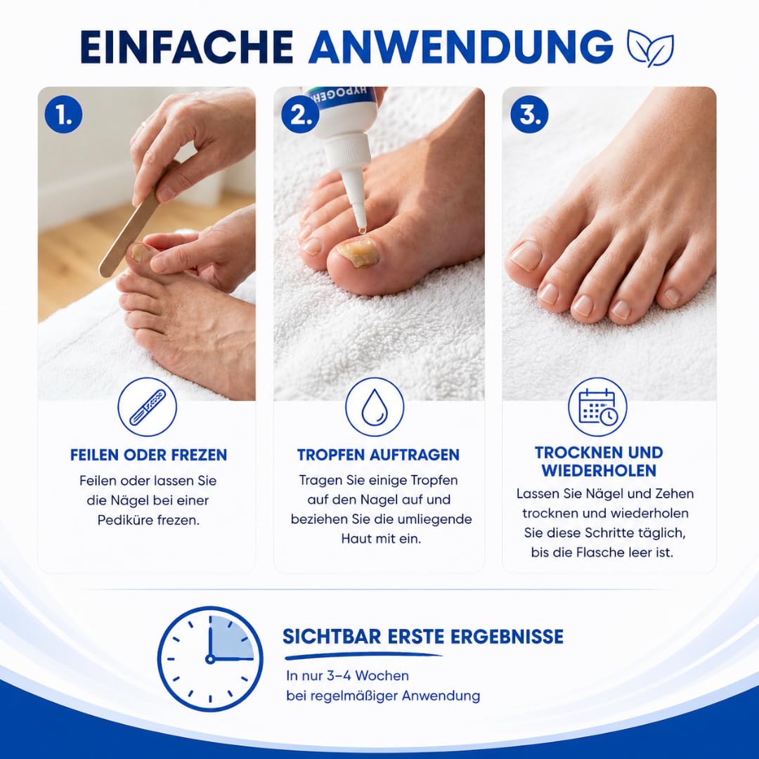 M-cose Nagelöl 100ml – Kosmetische Pflege bei Nagelpilz – Schnell & Intensiv – Wasserfreie Formel mit Teebaumöl & Allantoin – Für brüchige, verdickte & verfärbte Nägel