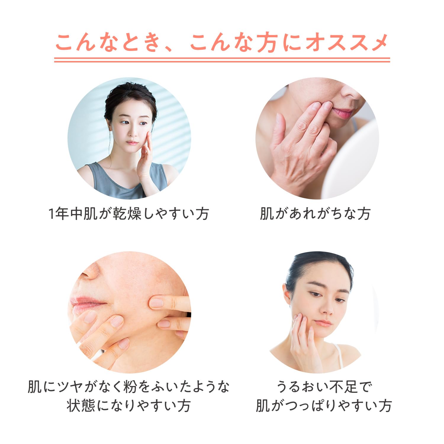 Amazon | アベンヌ(Avene) イドランス クリーム N 39g | クリーム